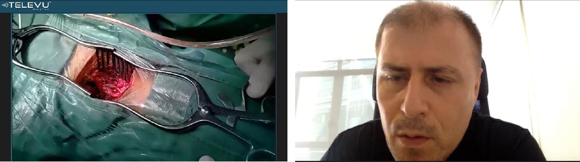 OO Afghanistan Use Case-04