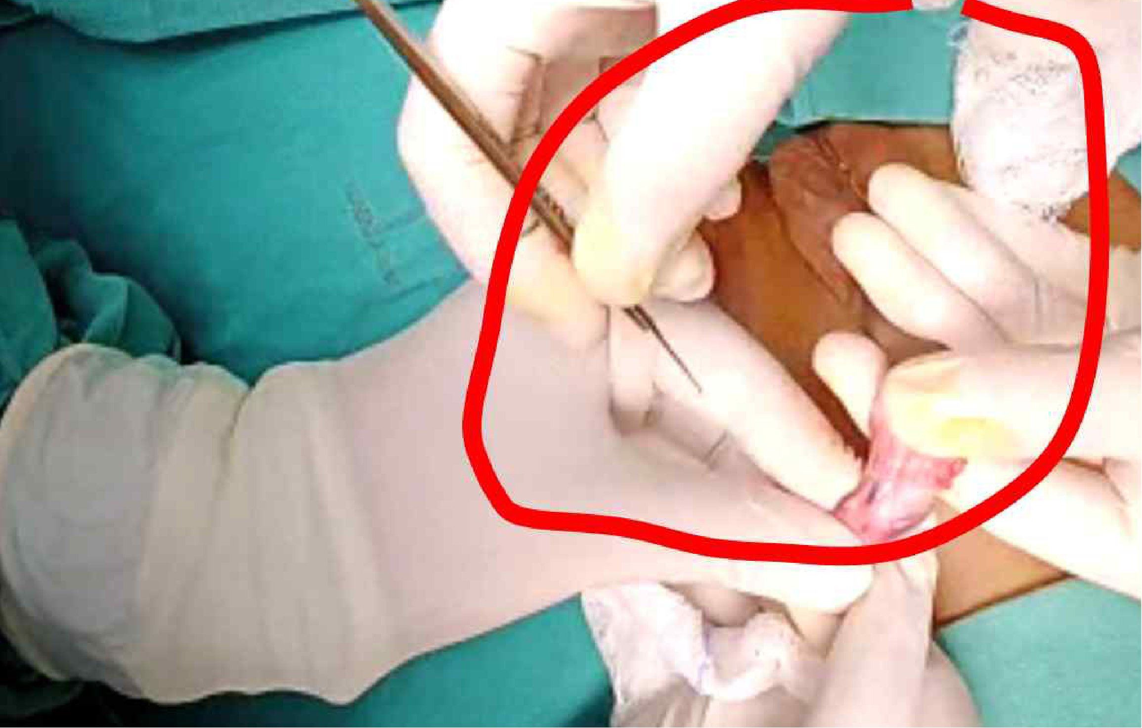 OO Ethiopia Use Case v2-03