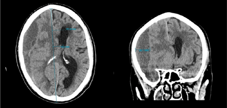 OO Greenland Case-03